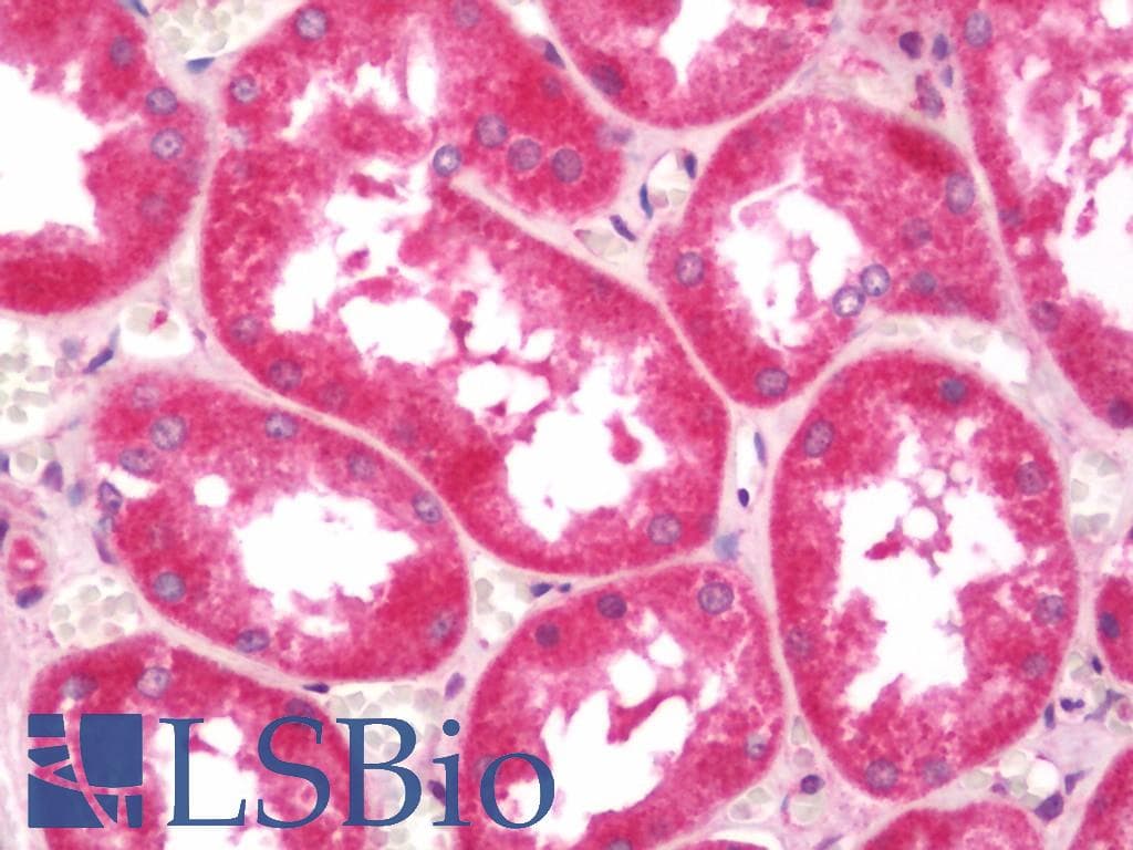 IHC-plus™ Polyclonal Rabbit anti-Human TWIK1 / KCNK1 Antibody (IHC, IF, WB)