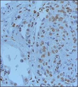 GREM1 / Gremlin-1 Antibody (aa147-175)
