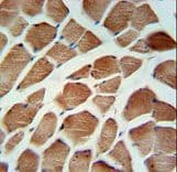 Polyclonal Rabbit anti-Human CA-VB / CA5B Antibody (aa253-283, IHC, WB)