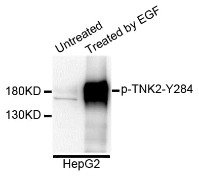 TNK2 / ACK1 Antibody (phospho-Tyr284)