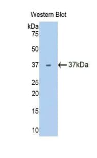 FLT1 / VEGFR1 Antibody (aa27-329)