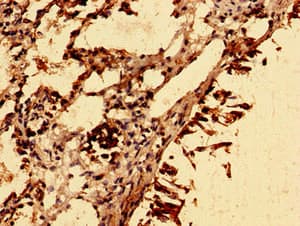 SLC39A8 / ZIP8 Antibody