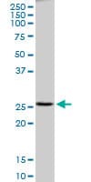 IHC-plus™ PRDX4 / Peroxiredoxin 4 Antibody (clone 2C12)