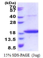 Human STEAP4 Protein (Recombinant His)