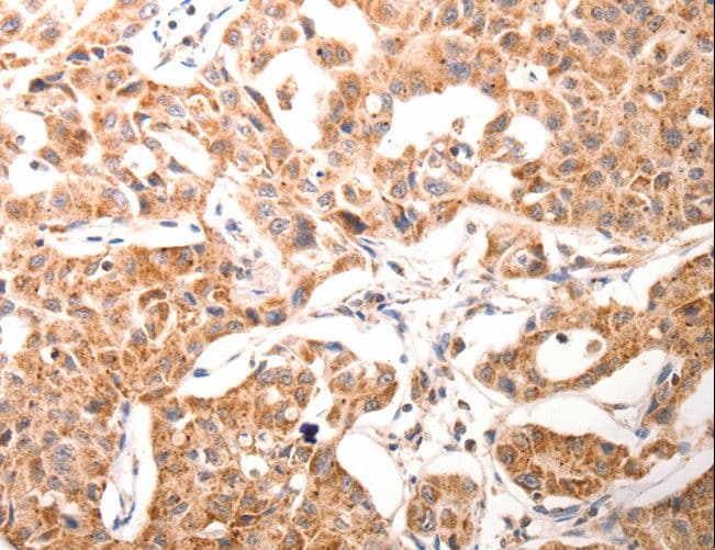 Osteocalcin Antibody