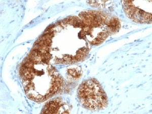 Monoclonal Mouse anti-Human TAG-72 Antibody (clone B72.3 + CA72/733, Ready-to-Use, IHC, IF, WB)