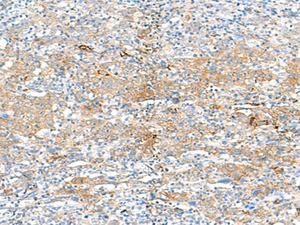 HLA-DRB3 Antibody