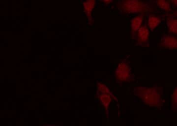AK6 / Adenylate Kinase 6 Antibody