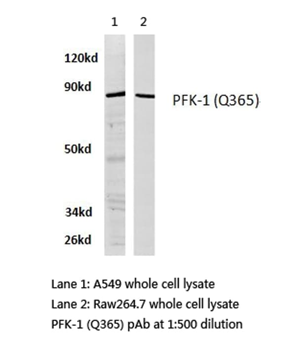 PFKP Antibody (Gln365)