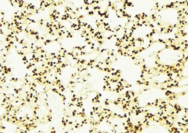 Polyclonal Rabbit anti-Human STK9 / CDKL5 Antibody (IHC, WB)
