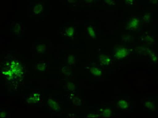 Alpha-Fetoprotein Antibody (aa19-397, clone OTI2F11, Carrier-free)