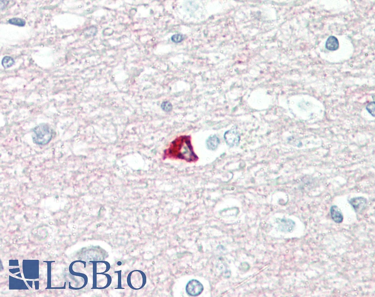 PathPlus™ SNAP25 Antibody (aa151-200)