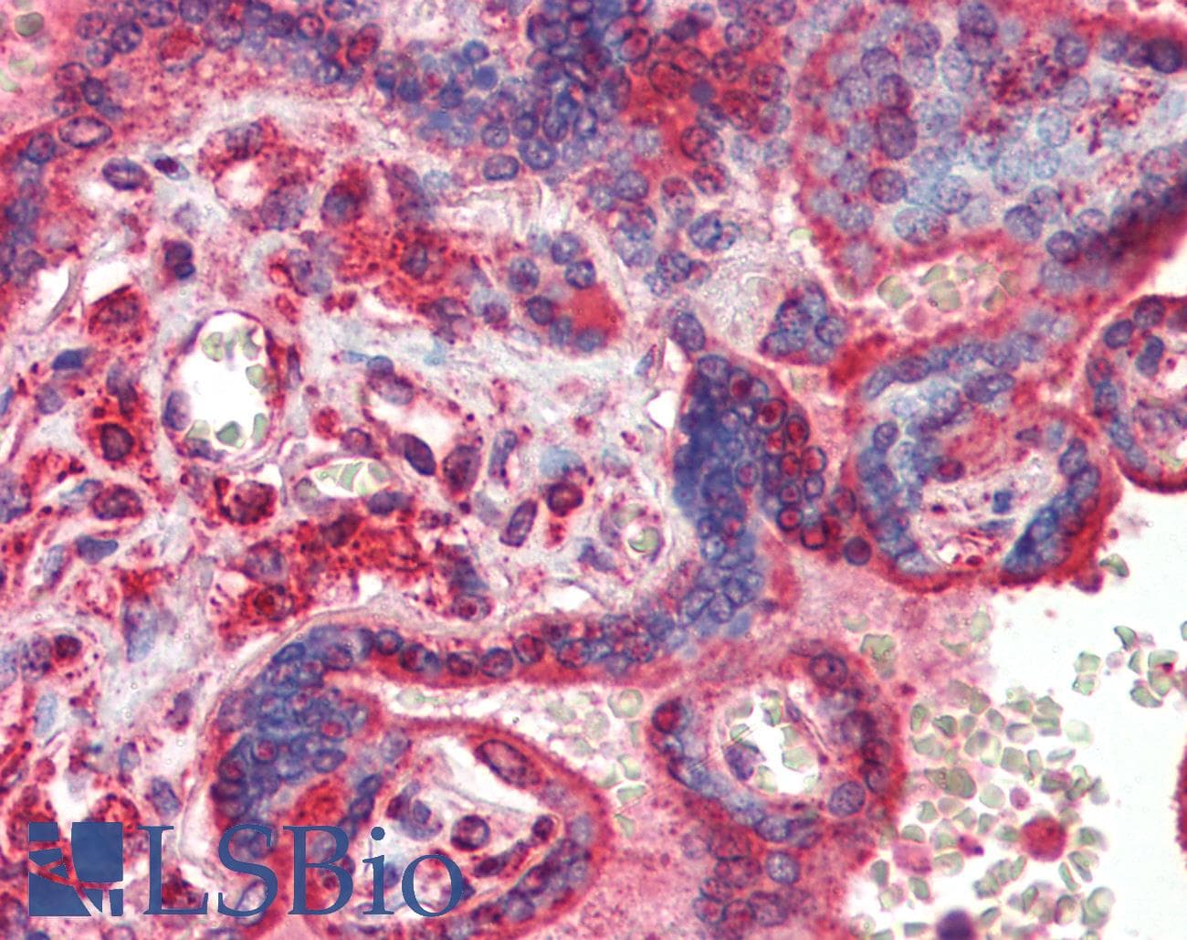 Polyclonal Rabbit anti-Mouse ATF4 Antibody (N-Terminus, IHC, WB)