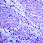 PDPK1 / PDK1 Antibody