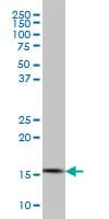 IHC-plus™ CGGBP1 Antibody (clone 1D11)