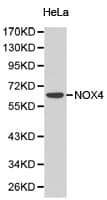 Polyclonal Rabbit anti-Human NOX4 Antibody (IHC, WB)