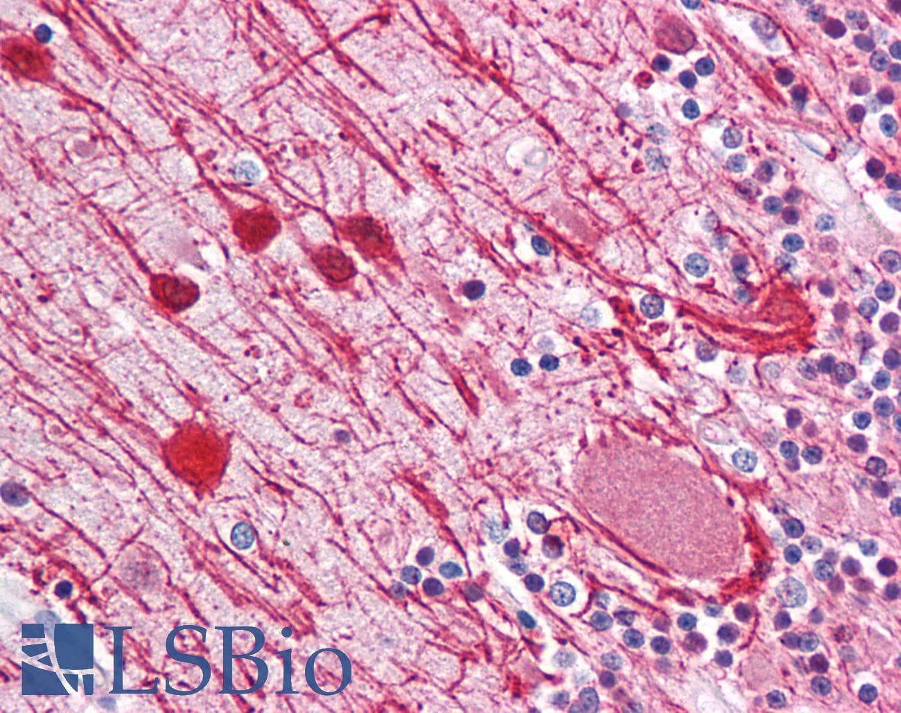 PathPlus™ Monoclonal Mouse anti-Human NF-L / NEFL Antibody (clone 2F11, IHC, WB)