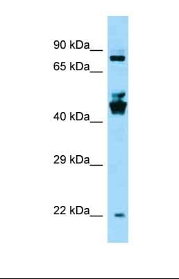 Polyclonal Rabbit anti-Human SPDYE3 Antibody (aa370-419, WB)
