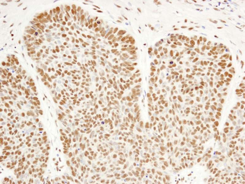 HFip1 / FIP1L1 Antibody (aa544-594)
