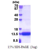 Human CSAG1 Protein (Recombinant His)
