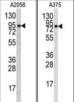 ATG9A Antibody (aa717-746)