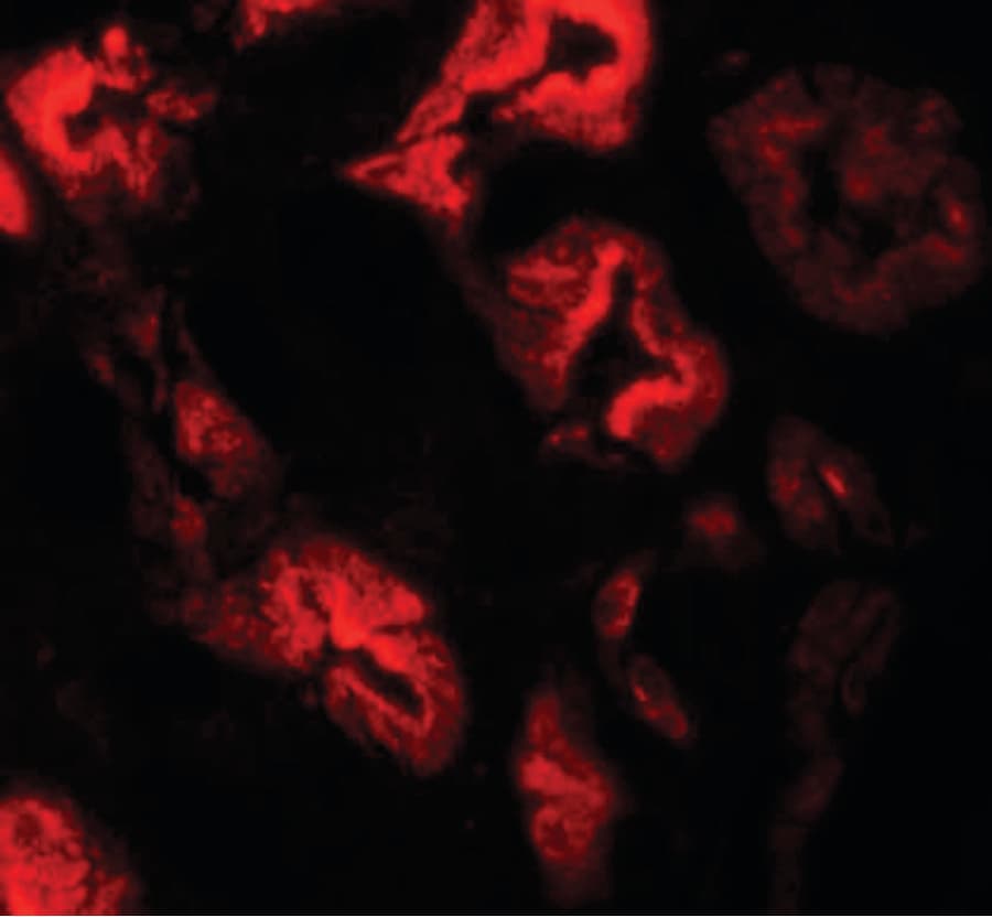 IHC-plus™ Polyclonal Rabbit anti-Human ZNF346 Antibody (IHC, IF, WB)