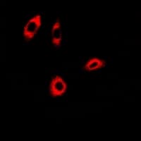 Polyclonal Rabbit anti-Human ACCS / ACS Antibody (IHC, IF, WB)