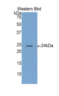 GREM1 / Gremlin-1 Antibody (aa26-184, Biotin)