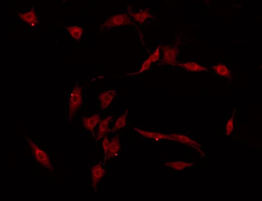 RGAG1 Antibody