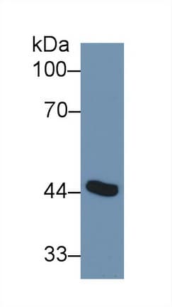 ADA / Adenosine Deaminase Antibody (aa11-280)