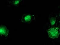 CTNNB1 / Beta Catenin Antibody (clone OTI12H7)