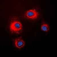 Polyclonal Rabbit anti-Human STMN1 / Stathmin / LAG Antibody (N-Terminus, IHC, IF, WB)