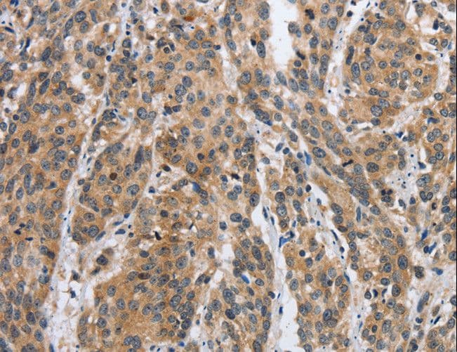 DSP / Desmoplakin Antibody