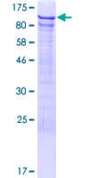 Human DDX42 Protein (Recombinant GST)
