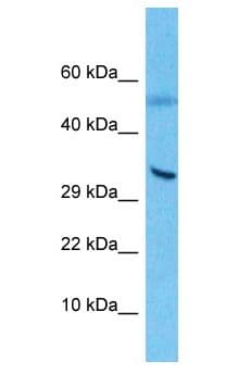 YBX1 / YB1 Antibody (aa201-250)