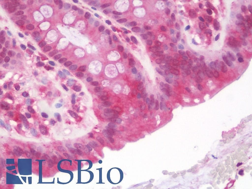 IHC-plus™ UBE2G2 Antibody (clone 4D6)