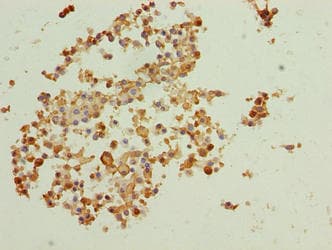 Polyclonal Rabbit anti-Human BTBD6 Antibody (IHC, WB)