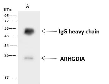 Polyclonal Rabbit anti-Human ARHGDIA / RHOGDI Antibody (IHC, WB)