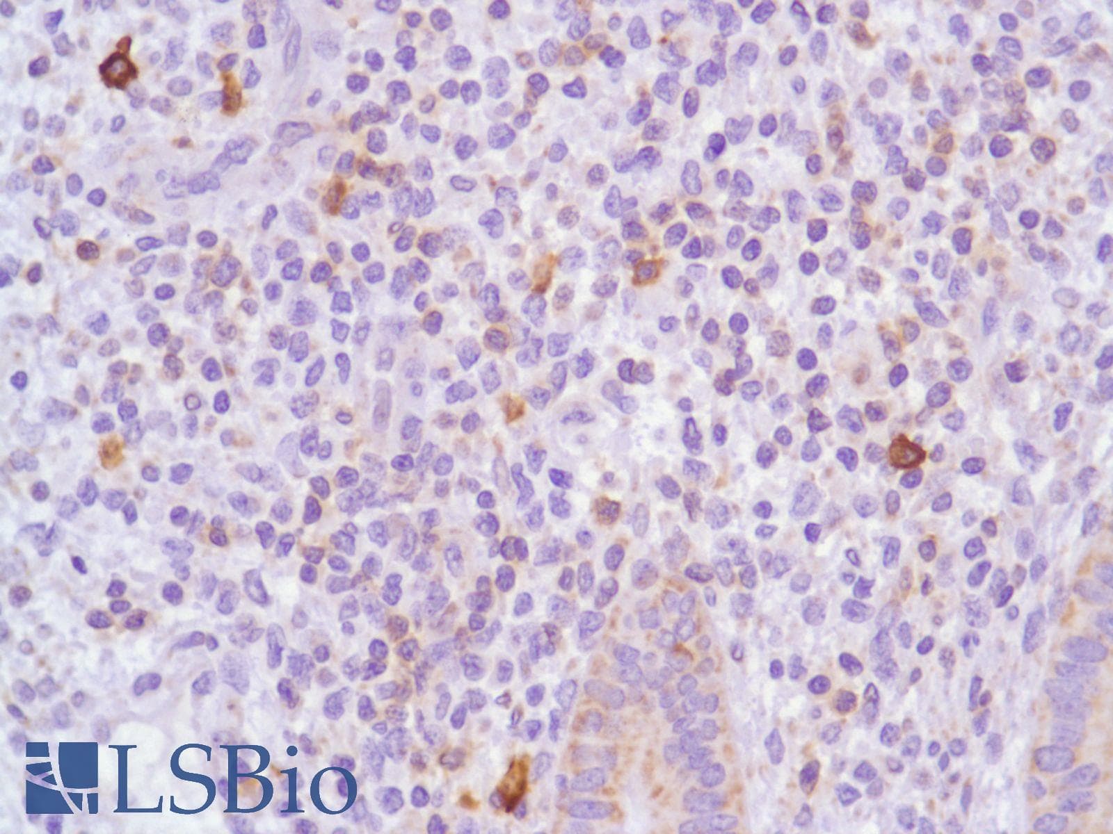 ICOS / CD278 Antibody (C-Terminus, clone SP98)