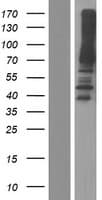 Cytokine IK Protein (Over-Expression Lysate Myc-DDK (Flag))