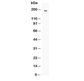 ABCC4 / MRP4 Antibody
