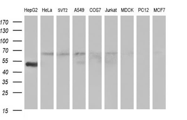 FGG / Fibrinogen Gamma Antibody (clone OTI1D1, Carrier-free)