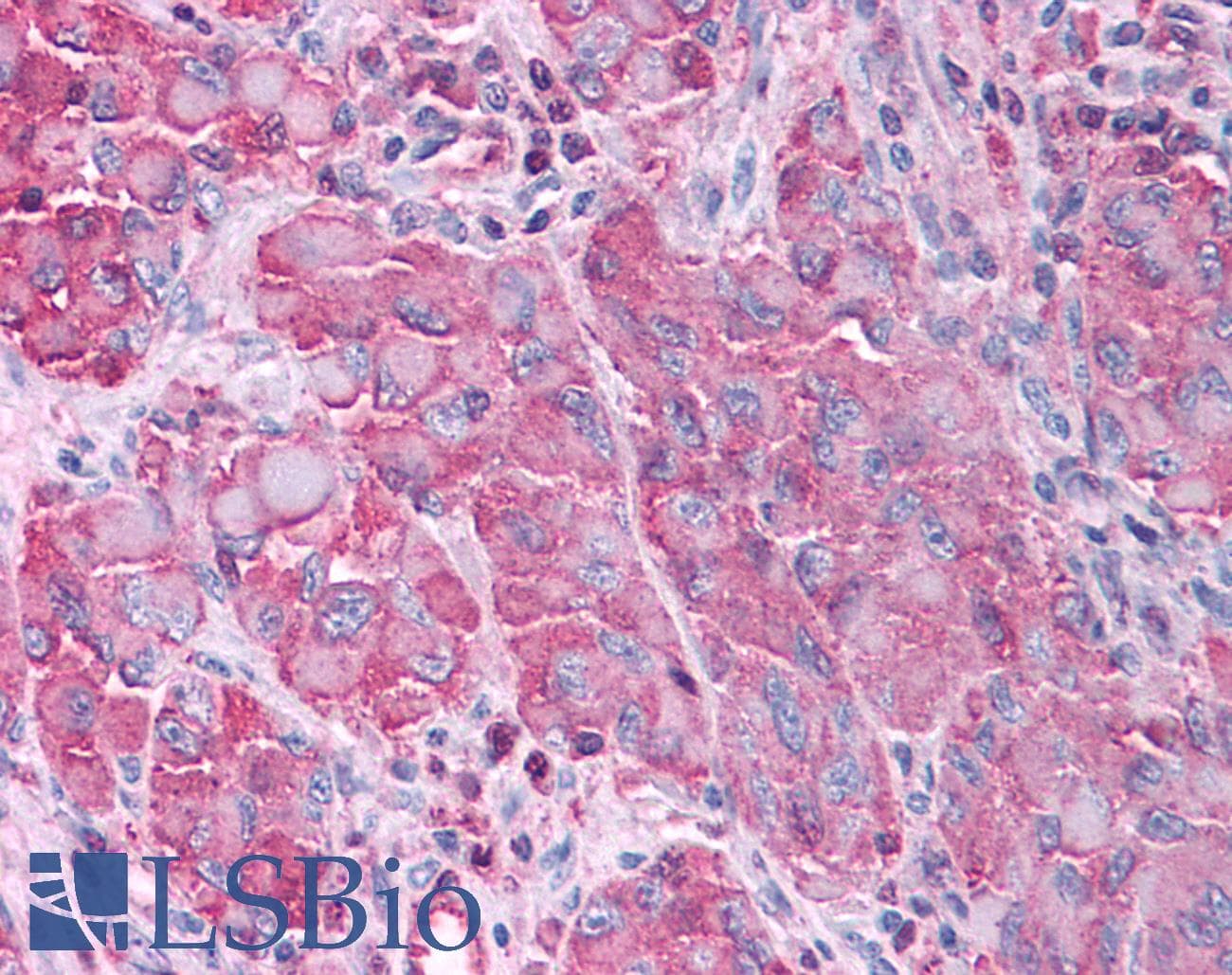 PathPlus™ Polyclonal Rabbit anti-Human MAPK3 / ERK1 Antibody (Internal, IHC)