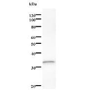DDX17 Antibody (clone 2248C2a)
