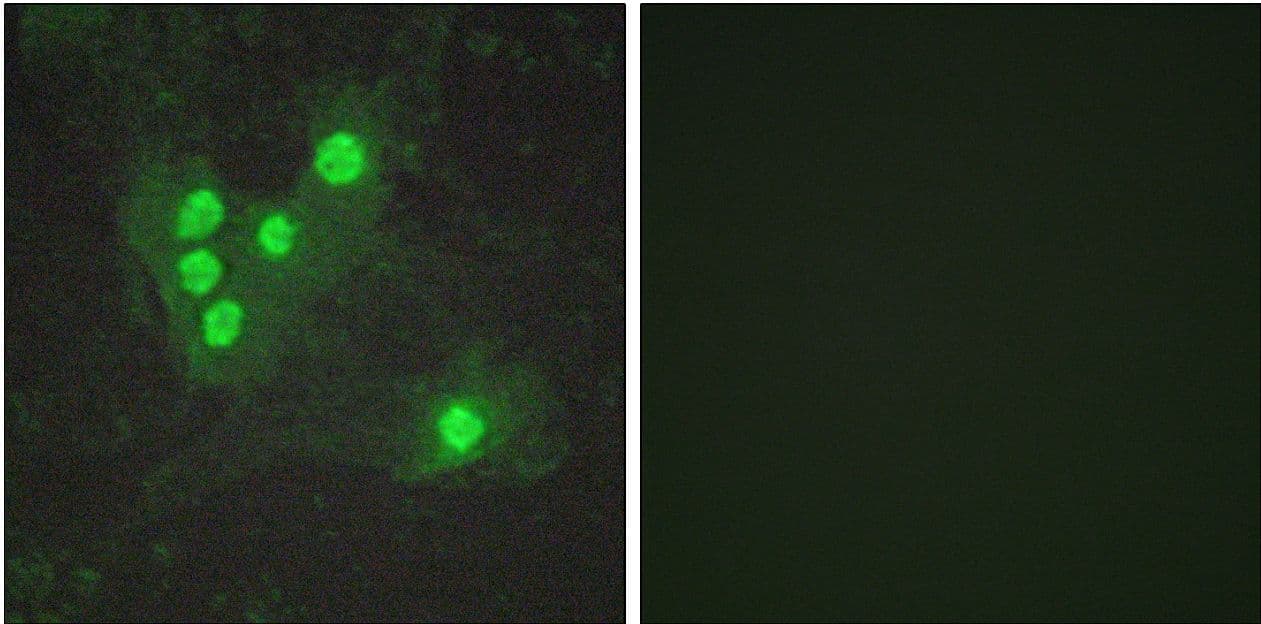 AKT1 + AKT2 + AKT3 Antibody (phospho-Ser473)