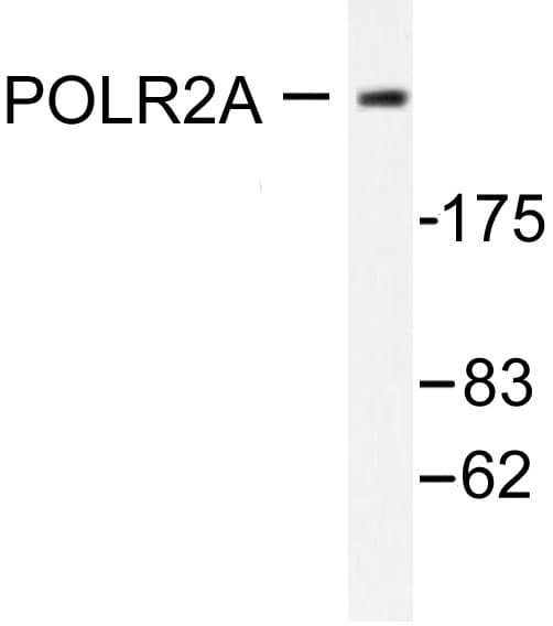 Polyclonal Rabbit anti-Human POLR2A / RNA polymerase II Antibody (Pro1613, IHC, IF, WB)