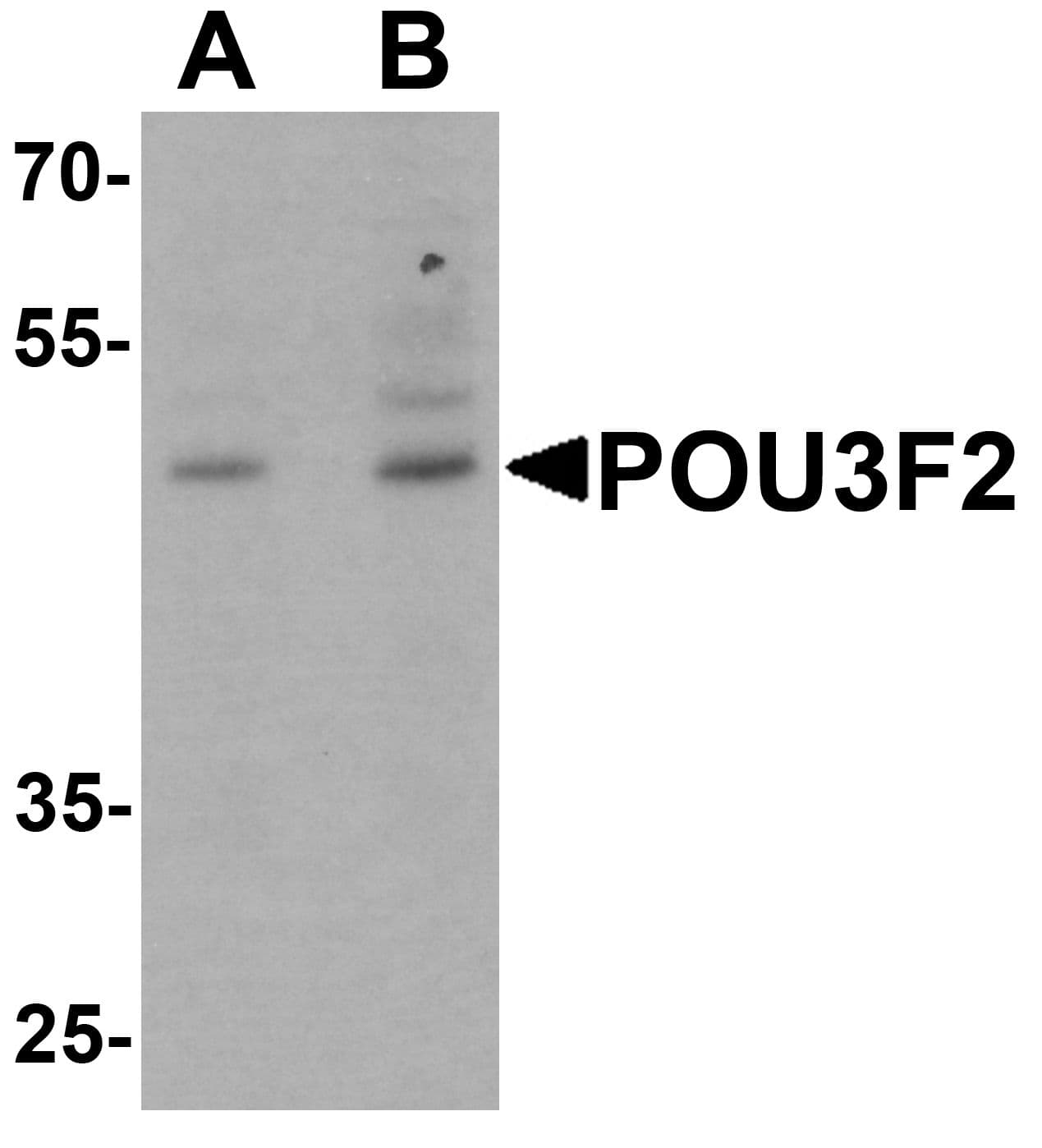 IHC-plus™ BRN2 / POU3F2 Antibody