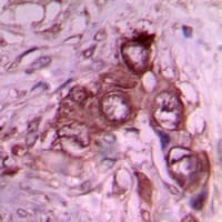 Polyclonal Rabbit anti-Human LAMB1 / Laminin Beta 1 Antibody (C-Terminus, IHC, WB)
