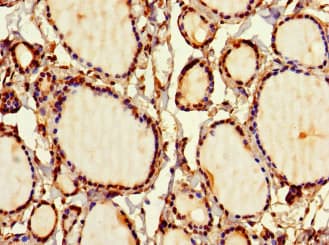 SIRPB1 / CD172b Antibody