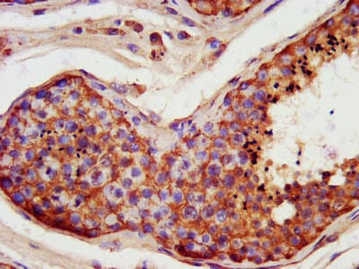 Polyclonal Rabbit anti-Human FATE1 Antibody (WB)